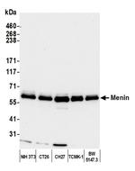 Menin Antibody in Western Blot (WB)