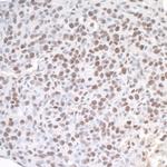 ASH2 Antibody in Immunohistochemistry (Paraffin) (IHC (P))