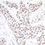 ASH2 Antibody in Immunohistochemistry (Paraffin) (IHC (P))