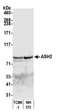 ASH2 Antibody in Western Blot (WB)