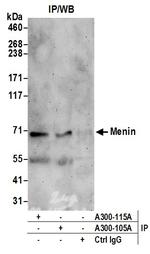 Menin Antibody in Immunoprecipitation (IP)