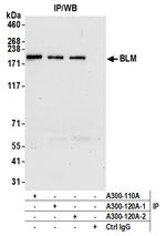 BLM Antibody in Immunoprecipitation (IP)