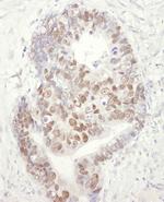 MCM3 Antibody in Immunohistochemistry (Paraffin) (IHC (P))