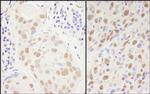 Sp1 Antibody in Immunohistochemistry (Paraffin) (IHC (P))