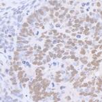 Sp1 Antibody in Immunohistochemistry (Paraffin) (IHC (P))