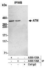 ATM Antibody in Immunoprecipitation (IP)