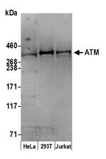 ATM Antibody in Western Blot (WB)