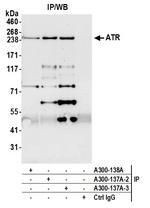 ATR Antibody in Immunoprecipitation (IP)