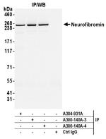 NF1 Antibody in Immunoprecipitation (IP)