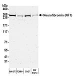 NF1 Antibody in Western Blot (WB)