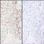 Phospho-XRCC1 (Ser461) Antibody in Immunohistochemistry (Paraffin) (IHC (P))