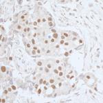 Leo1 Antibody in Immunohistochemistry (Paraffin) (IHC (P))