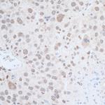 Leo1 Antibody in Immunohistochemistry (Paraffin) (IHC (P))