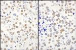 QKI Antibody in Immunohistochemistry (Paraffin) (IHC (P))