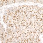 MCM3 Antibody in Immunohistochemistry (Paraffin) (IHC (P))