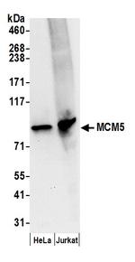 MCM5 Antibody in Western Blot (WB)