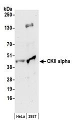 CKII alpha Antibody in Western Blot (WB)