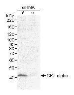 CKII alpha Antibody in Western Blot (WB)