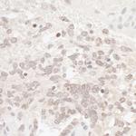 CKII alpha Antibody in Immunohistochemistry (Paraffin) (IHC (P))