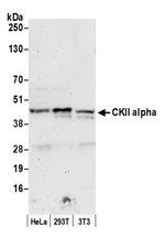 CKII alpha Antibody in Western Blot (WB)