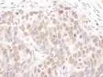 CKII alpha Antibody in Immunohistochemistry (Paraffin) (IHC (P))