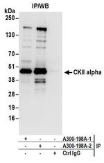 CKII alpha Antibody in Immunoprecipitation (IP)