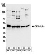 CKII alpha Antibody in Western Blot (WB)