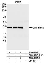 CKII alpha' Antibody in Immunoprecipitation (IP)