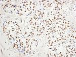 BHC110/LSD1 Antibody in Immunohistochemistry (Paraffin) (IHC (P))