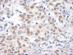 BHC110/LSD1 Antibody in Immunohistochemistry (Paraffin) (IHC (P))