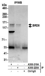 BRD8 Antibody in Immunoprecipitation (IP)