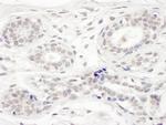 BRD8 Antibody in Immunohistochemistry (Paraffin) (IHC (P))