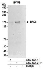 BRD8 Antibody in Immunoprecipitation (IP)