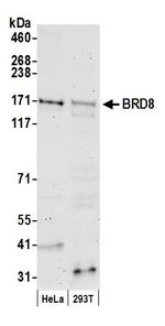 BRD8 Antibody in Western Blot (WB)