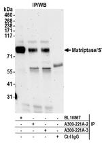 Matriptase/ST14 Antibody in Immunoprecipitation (IP)