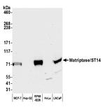 Matriptase/ST14 Antibody in Western Blot (WB)