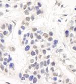 Artemis Antibody in Immunohistochemistry (Paraffin) (IHC (P))