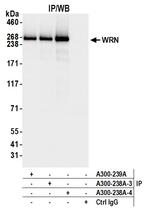 WRN Antibody in Immunoprecipitation (IP)