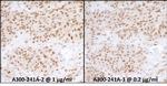 RPA70 Antibody in Immunohistochemistry (Paraffin) (IHC (P))