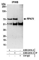 RPA70 Antibody in Immunoprecipitation (IP)