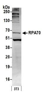 RPA70 Antibody in Western Blot (WB)