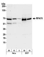 RPA70 Antibody in Western Blot (WB)