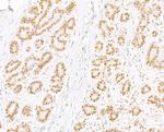 RPA32 Antibody in Immunohistochemistry (Paraffin) (IHC (P))