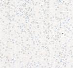 RPA32 Antibody in Immunohistochemistry (Paraffin) (IHC (P))