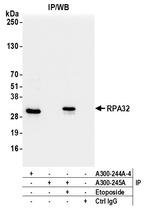 RPA32 Antibody in Immunoprecipitation (IP)