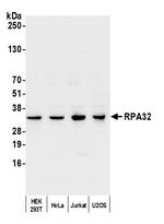 RPA32 Antibody in Western Blot (WB)