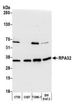 RPA32 Antibody in Western Blot (WB)