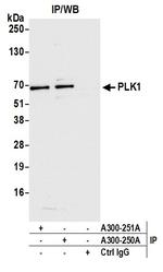 PLK1 Antibody in Immunoprecipitation (IP)