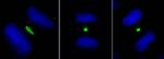 PLK1 Antibody in Immunocytochemistry (ICC/IF)