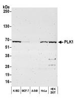 PLK1 Antibody in Western Blot (WB)